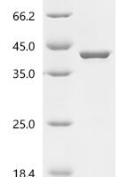 Human Synapsin-1 (SYN1), partial Recombinant Protein, C-His - BioCrest Sci