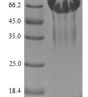 Human Mucosal addressin cell adhesion molecule 1 (MADCAM1), partial Recombinant Protein, C-His-Myc - BioCrest Sci