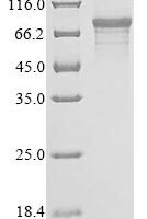 Human ORC ubiquitin ligase 1 (OBI1), partial Recombinant Protein - BioCrest Sci