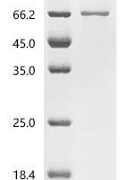 Mouse Cytosolic carboxypeptidase 6 (Agbl4) Recombinant Protein - BioCrest Sci