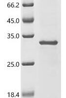 Bacillus licheniformis Glutamyl endopeptidase (blaSE) Recombinant Protein - BioCrest Sci