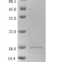 Mouse Hemoglobin subunit beta-2 (Hbb-b2) Recombinant Protein, N-His - BioCrest Sci