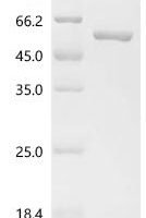 avian paramyxovirus 4 Nucleocapsid (NP) Recombinant Protein, C-His - BioCrest Sci