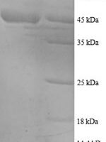 Human 40S ribosomal protein S18 (RPS18) Recombinant Protein - BioCrest Sci
