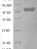 Human WD repeat-containing protein 1 (WDR1), partial Recombinant Protein - BioCrest Sci