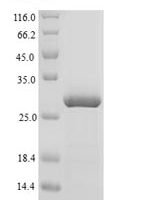 Anas platyrhynchos Lysozyme C-1 Recombinant Protein - BioCrest Sci