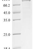 Bovin Sorting nexin-5 (SNX5) Recombinant Protein - BioCrest Sci