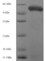 Human Fibroleukin (FGL2) Recombinant Protein - BioCrest Sci