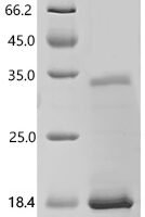 Human Solute carrier family 15 member 3 (SLC15A3), partial Recombinant Protein - BioCrest Sci