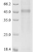 Human Vitamin K-dependent protein C（PROC) Recombinant Protein - BioCrest Sci