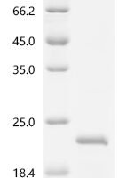 Human Interleukin-15 (IL15) Recombinant Protein, C-His - BioCrest Sci