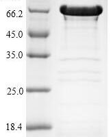 Human Protein deacetylase HDAC6 (HDAC6), partial Recombinant Protein - BioCrest Sci