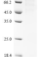 Human Schlafen family member 11 (SLFN11) Recombinant Protein, N-His - BioCrest Sci