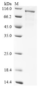 Human Schlafen family member 11 (SLFN11) Recombinant Protein, N-His, Homo sapiens (Human), E.coli, N-terminal 6xHis-tagged, 106.9 kDa, purity >≥ 85% as determined by SDS-PAGE.