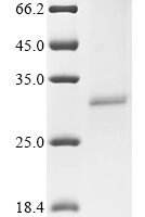 Human Acetylcholine receptor subunit alpha (CHRNA1), partial Recombinant Protein, C-His - BioCrest Sci