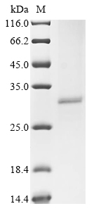 Human Acetylcholine receptor subunit alpha (CHRNA1), partial Recombinant Protein, C-His, Homo sapiens (Human), Baculovirus, C-terminal 6xHis-tagged, 32.7 kDa, purity >≥ 90% as determined by SDS-PAGE.
