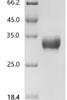 Human CAMPATH-1 antigen (CD52), partial, Biotinylated Recombinant Protein, N-10His-Avi-BSA - BioCrest Sci