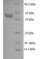 Leuconostoc mesenteroides subsp. Cremoris D-lactate dehydrogenase Recombinant Protein - BioCrest Sci