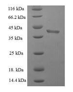 Human BH3-interacting domain death agonist (BID) Recombinant Protein - BioCrest Sci