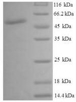 Human UDP-glucose 4-epimerase (GALE) Recombinant Protein - BioCrest Sci