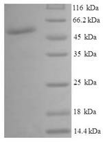 Human UDP-glucose 4-epimerase (GALE) Recombinant Protein, Homo sapiens (Human), E.coli, N-terminal 6xHis-SUMO-tagged, 54.3 kDa, purity >≥ 90% as determined by SDS-PAGE.