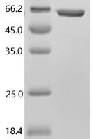 Human Mitochondrial fission 1 protein (FIS1), partial, Biotinylated Recombinant Protein - BioCrest Sci