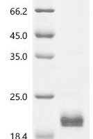 Mouse Cathelicidin antimicrobial peptide (Camp) Recombinant Protein - BioCrest Sci