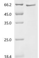 Human Peroxisome proliferator-activated receptor gamma (PPARG) Recombinant Protein, C-His - BioCrest Sci