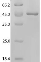 Human Transaldolase (TALDO1) Recombinant Protein, C-His, aa 1–337, E.coli - BioCrest Sci