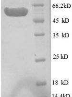 Escherichia coli Inositol-1-monophosphatase (suhB) Recombinant Protein - BioCrest Sci