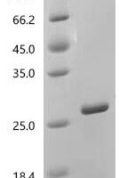 Arachis hypogaea Ara h 8 allergen Recombinant Protein, C-His, aa 1–157, E.coli - BioCrest Sci