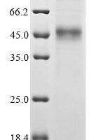 Human Cytokine-like protein 1 (CYTL1) Recombinant Protein - BioCrest Sci