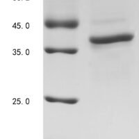 Human Cyclin-dependent kinase 7 (CDK7) Recombinant Protein, Tag-Free - BioCrest Sci