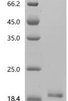 Bovine Fibroblast growth factor 2 (FGF2) Recombinant Protein, N-10His - BioCrest Sci