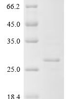 Human cytomegalovirus Protein UL16 (UL16), partial Recombinant Protein - BioCrest Sci