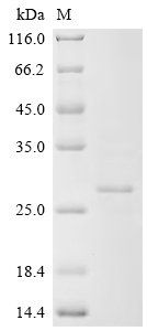 Human cytomegalovirus Protein UL16 (UL16), partial Recombinant Protein, Human cytomegalovirus (strain AD169) (HHV-5) (Human herpesvirus 5), E.coli, N-terminal 10xHis-tagged and C-terminal Myc-tagged, 25.2 kDa, purity >≥ 85% as determined by SDS-PAGE.