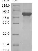 Human Transcription factor E2F6 (E2F6) Recombinant Protein - BioCrest Sci