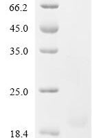 Horse Myelin P2 protein (PMP2) Recombinant Protein, N-His - BioCrest Sci