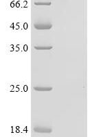 Human 2-5A-dependent ribonuclease (RNASEL), partial Recombinant Protein, C-10His - BioCrest Sci