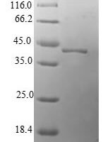 Human Protein mago nashi homolog (MAGOH) Recombinant Protein - BioCrest Sci