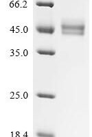 Human T-cell surface glycoprotein CD3 gamma chain (CD3G), partial Recombinant Protein - BioCrest Sci