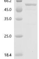 Human LIM and SH3 domain protein 1 (LASP1), partial Recombinant Protein - BioCrest Sci