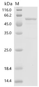 Human LIM and SH3 domain protein 1 (LASP1), partial Recombinant Protein, Homo sapiens (Human), E.coli, N-terminal GST-tagged, 54.5 kDa, purity >≥ 85% as determined by SDS-PAGE.