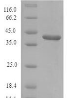 Rat Lumican (Lum) Recombinant Protein, N-His, aa 19–338, E.coli - BioCrest Sci