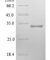 Human Cytochrome b-c1 complex subunit 10 protein (UQCR11) Recombinant Protein - BioCrest Sci
