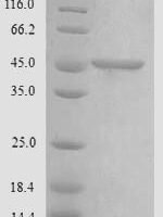 Human Chitinase domain-containing protein 1 (CHID1) Recombinant Protein, N-His, aa 20–393, Yeast - BioCrest Sci