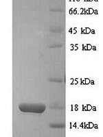 Mouse D-dopachrome decarboxylase (Ddt) Recombinant Protein, N-His, aa 2–118, Yeast - BioCrest Sci