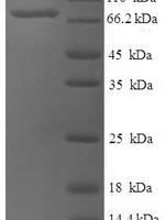 Human Set1/Ash2 histone methyltransferase complex subunit ASH2 (ASH2L) Recombinant Protein - BioCrest Sci