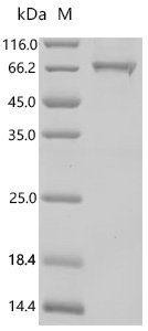 Mouse Kelch-like ECH-associated protein 1 (Keap1) Recombinant Protein, N-10His/C-Twin-Strep, Mammalian cell, N-terminal 10xHis-tagged and C-terminal Twin-Strep-tagged, 74.0 kDa, purity >≥ 95% as determined by SDS-PAGE.