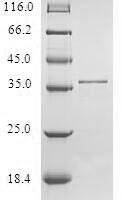Human Small muscular protein (SMPX) Recombinant Protein - BioCrest Sci